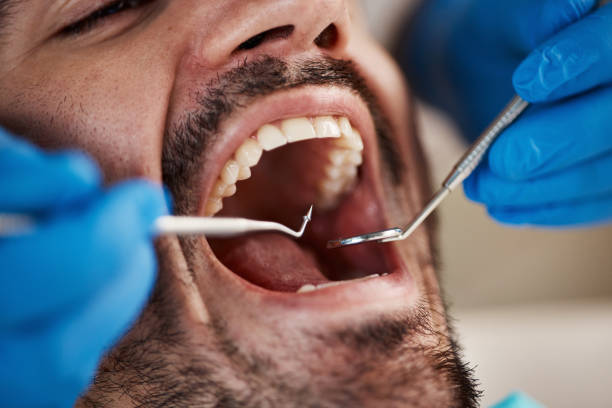 Best Broken or Chipped Tooth Repair in Mantua, VA